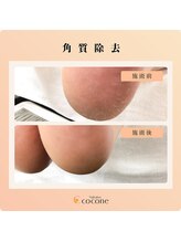 ココネ(cocone)/SPフットケア