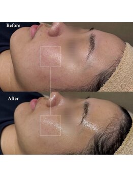 韓美(KANBI)/韓国肌管理Before After