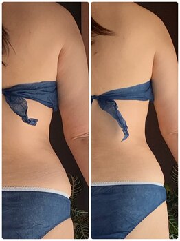 ヨサ パーク コアハート(YOSA PARK CORE HEART)/腰回りの浮き輪1回でこの効果