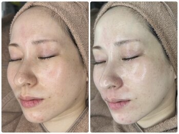 ムゥ(Mwoo)/ララピール/ララピール西宮