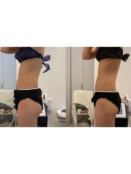 サイズダウンを目指したい