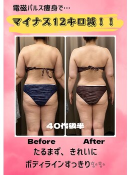 カルム 妙蓮寺(CALME)/