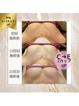 ロココ 町田店(Rococo)/C→Eの2カップUP！