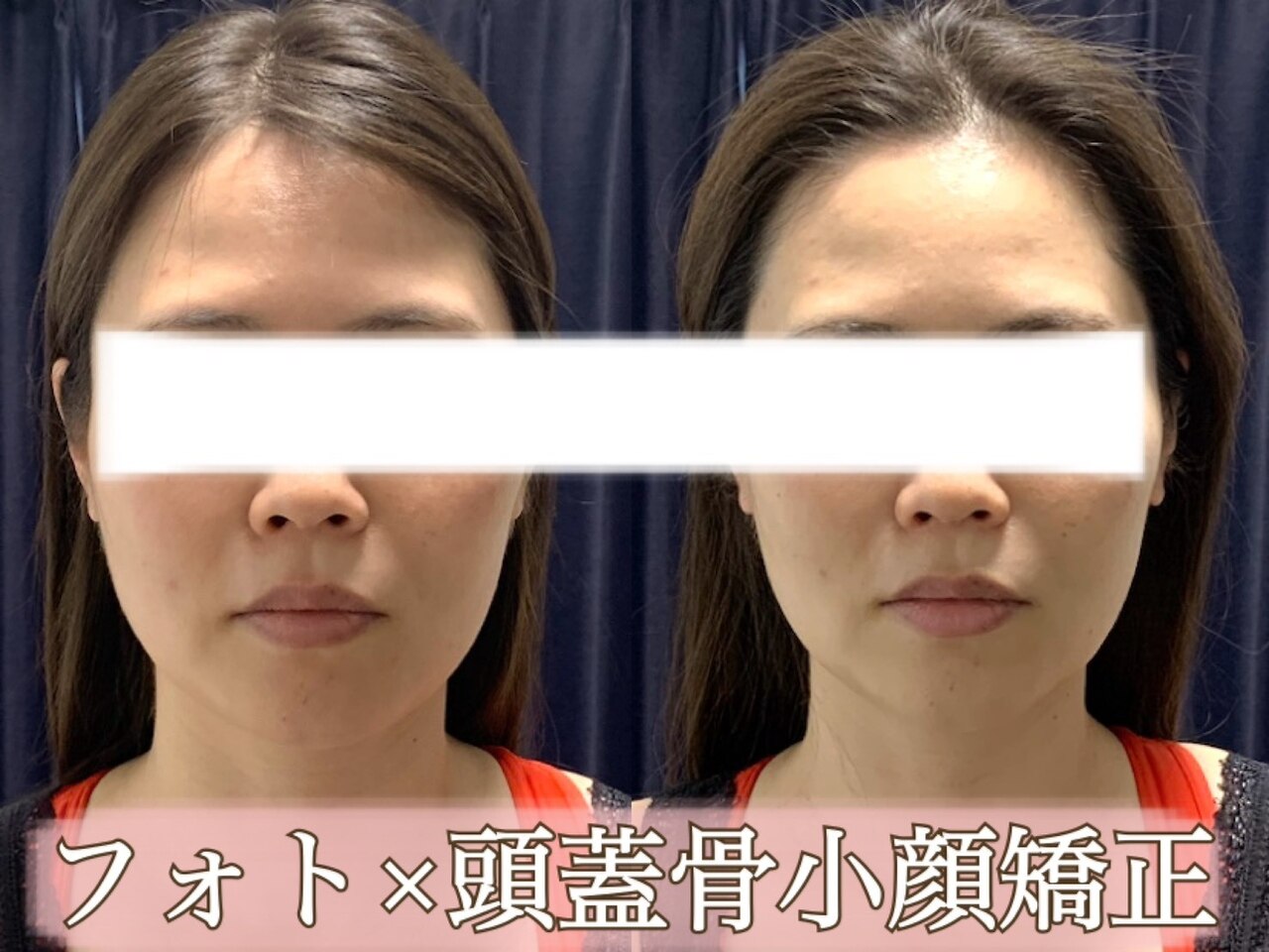 広島市でクラニオパシー・頭蓋骨矯正がおすすめのサロン