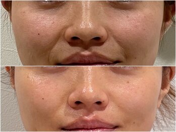 ステラ 武蔵小杉(Stella)/プラズマ B/A