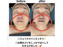 お顔のコリもしっかりほぐして造顔していきます☆