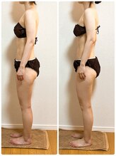 ソレイユ 北千住店(soleil)/全身が整う変化の記録（2）