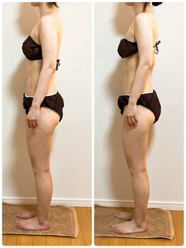 ソレイユ 北千住店(soleil)/全身が整う変化の記録（2）