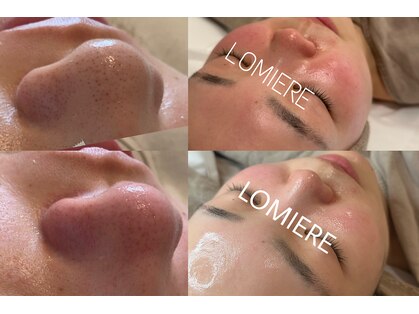ロミエール(LOMIERE)の写真