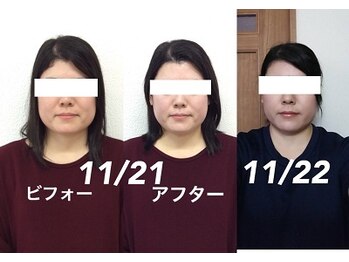 ビューティスタジオＫ/小顔矯正ビフォーアフター