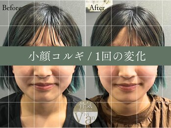 ヴィヴィアン 名駅店(骨気&Relaxation Vivian)/小顔コルギ