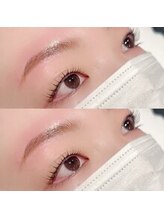 メリス(Mellis)/ラッシュリフト