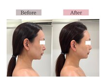 フロリール アザブジュウバン(FlorirAzabujuban)/幹細胞導入×造顔フェイシャル