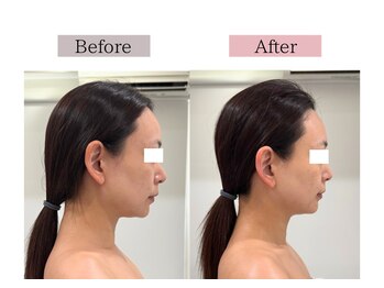 フロリール アザブジュウバン(FlorirAzabujuban)/幹細胞導入×造顔フェイシャル