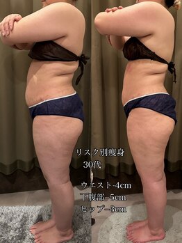 エステサロン 美飾り イオンモール木更津店/before⇒after/全身痩せ