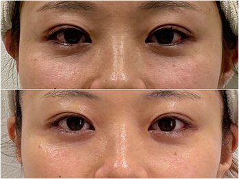 ステラ 武蔵小杉(Stella)/プラズマ B/A