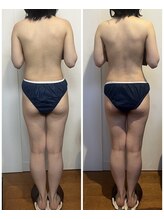 バンブー B2 新涯店(Bamboo)/筋膜リリース1回