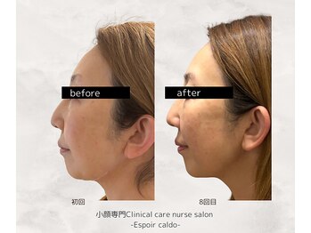 エスポワールカルド(Espoir caldo)/