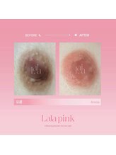 カルム(Calme)/Lalapink