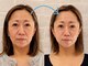 ネルジム 札幌店(NERU GYM)の写真