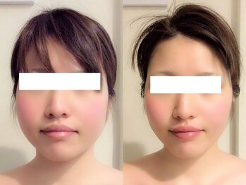 ボディーワークスナビ(Body Works Navi)/丸顔くっきり☆印象度UP！