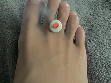 あくび 西麻布(aqu美)/お灸