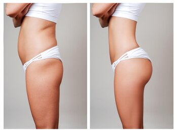 ストルツ(STOLZ)/お客様のビフォーアフター!