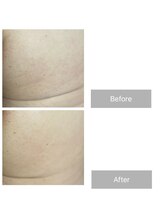 ダンニヒル(dannihil)/【おしりケア】50代会社員3回目