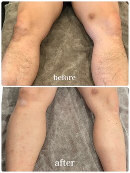 エリクサー 熊谷店(Elixir)/BeforeAfter