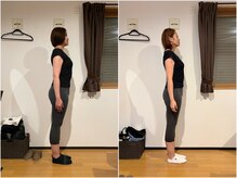 ステラ 武蔵小杉(Stella)/美骨エステ B/A