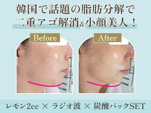 青空 チクシノサロン(SORA CHIKUSHINO SALON)