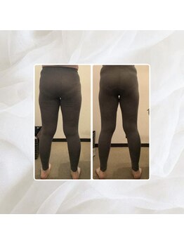 プリマプリート 名駅店/骨盤彫刻術