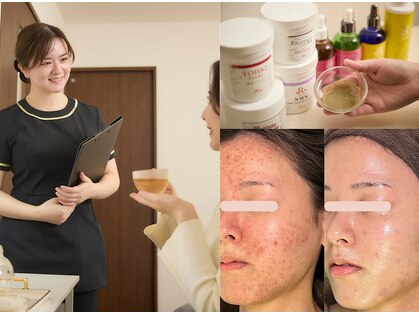 ソルニコン(Solnikon)の写真