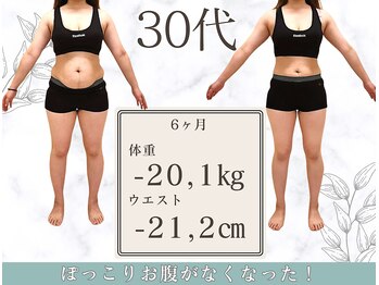 さくら通り美容整体院の写真/カラダの歪みを整え、デニムやスカートをきれいに履きこなせる美脚へ導きます＊まずはカウンセリングから！