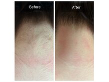 エルモア(L-MORE)の雰囲気(1回でもわかる。結果に高評価!!【脱毛/光脱毛/都度払いあり】)