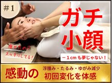 メディピークス