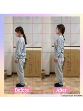 カイロプラクティック コダマ(KODAMA)/ビフォーアフター