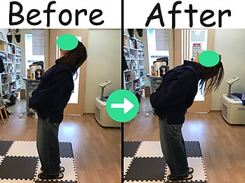 杉本接骨鍼灸院/坐骨からの神経が原因