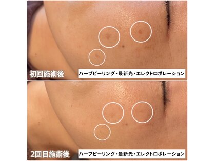 ベルエクラ(Bel Eclat)の写真