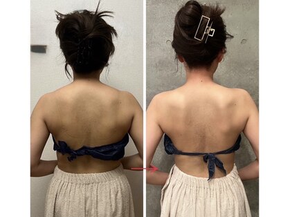 ビノワ(Binowa)の写真