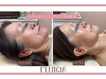 エレンシア(E'lencia)の雰囲気（１回で変化実感！【リフトアップ】機械×ハンドでスッキリ小顔へ）