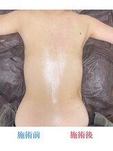 グレースヒーリング(GRACE HEALING)/リンパマッサージ変化