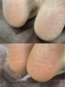 【フットケア*90分コース】角質ケア&リフレクソロジー付き
