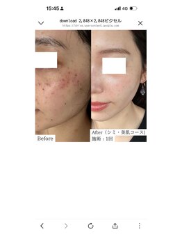 ナンバー(N°)の写真/シミケアしたい方におすすめ♪初めてのシミくすみケアの方に◎美肌へ導く