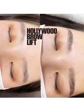 リンクス(links)/ハリウッドブロウリフト