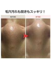 ビーフィール 府中店(be feel)/毛穴の黒ずみもスッキリ☆