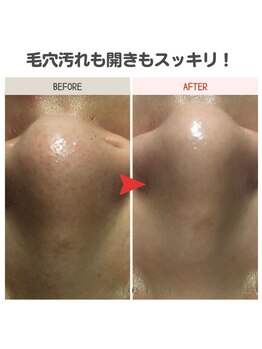 ビーフィール 府中店(be feel)/毛穴の黒ずみもスッキリ☆