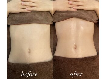 クオコア(KUOKOA)/Before/After