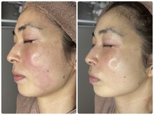 ムゥ(Mwoo)/ララピール/ララピール西宮