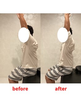 ナオル整体 福岡香椎院(NAORU整体)/30代男性施術事例【肩の可動域】